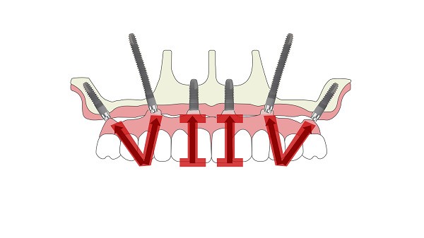 xYjQL5i3sI4Wl58i.jpg